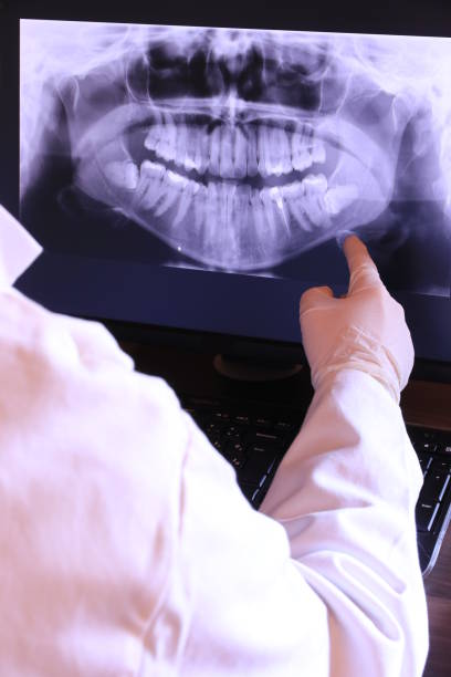 Best Emergency Treatment for Dental Infections or Abscesses in Yellow Springs, OH