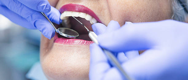 Best Weekend Emergency Dentist in Yellow Springs, OH